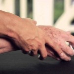 parkinson-ve-tms